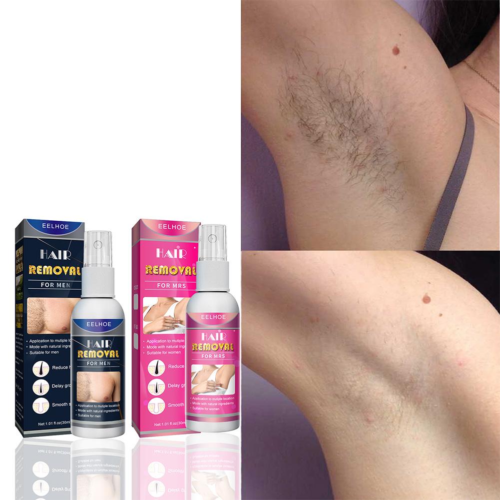 1/2PCS Super Natural Painless  - огляд і ціна Hair Care Lotion