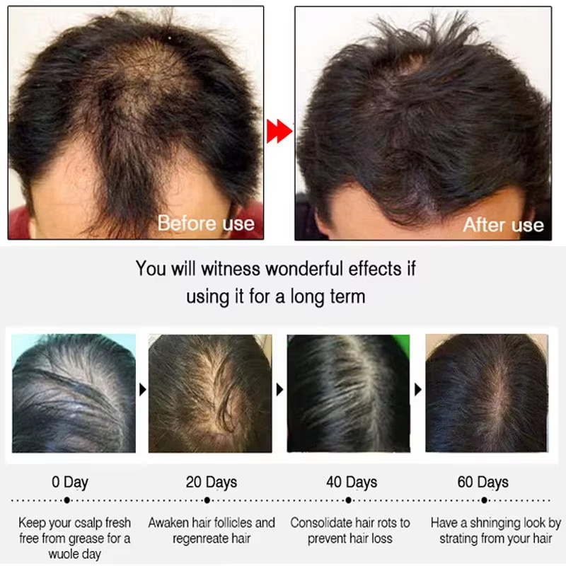 Fast Ginger Hair Growth Spray  - огляд і ціна Hair Care Lotion
